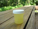 Urine Sample 00010 IR1.jpg (40830 bytes)